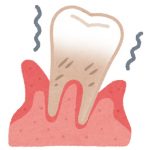 歯周病の症状や予防法。歯周病に効果のある市販の歯磨き粉
